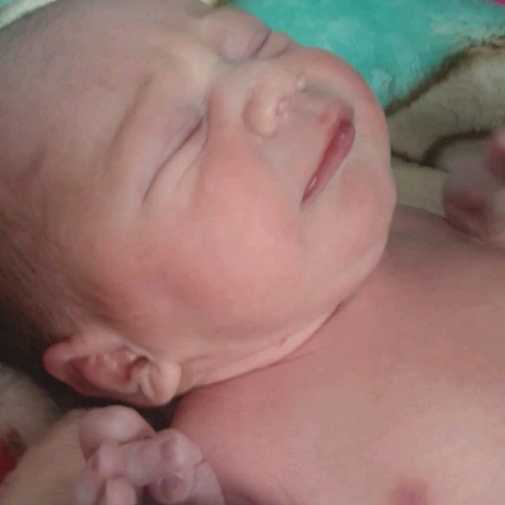 جراحی زایمان سزارین