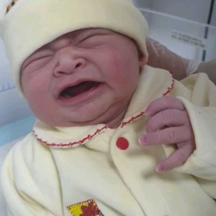 زایمان سزارین