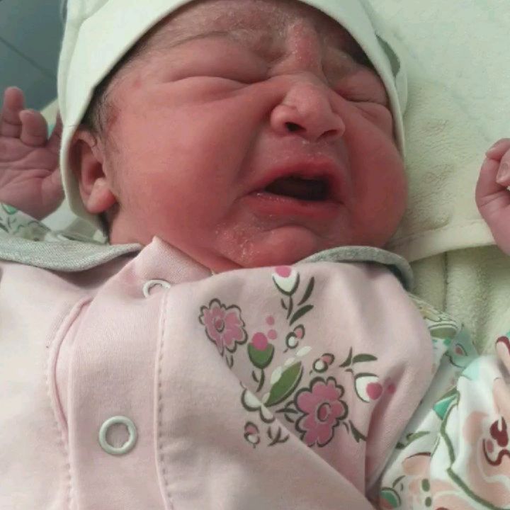 نوزاد به روش زایمان سزارین