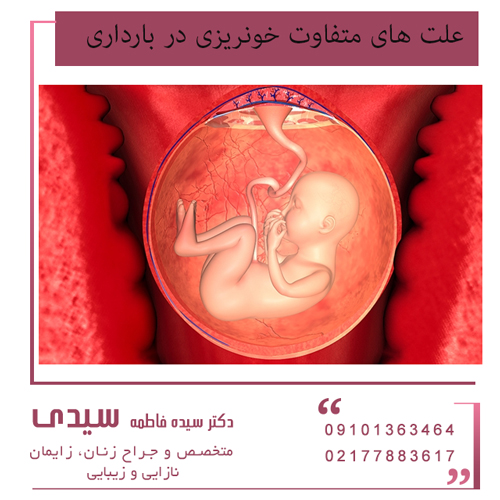علت خون ریزی در دوران بارداری