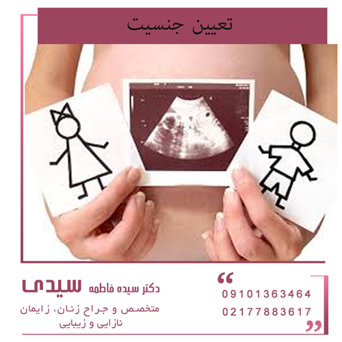 تعیین جنسیت جنین قبل از تولد