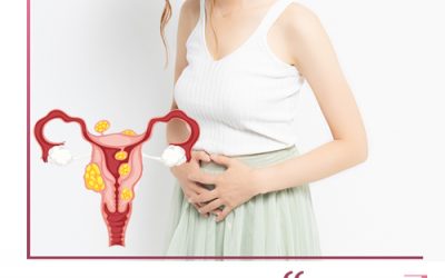 فیبروم رحم چیست؟علت وعلائم آن