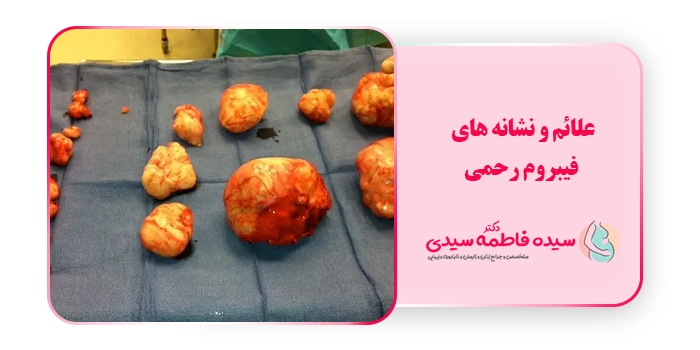 علائم و نشانه های فیبروم رحمی