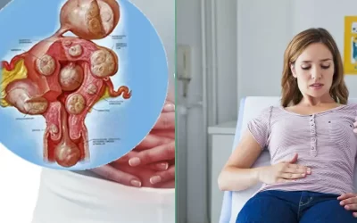آیا فیبروم رحم باعث مشکلات در بارداری می‌شود؟