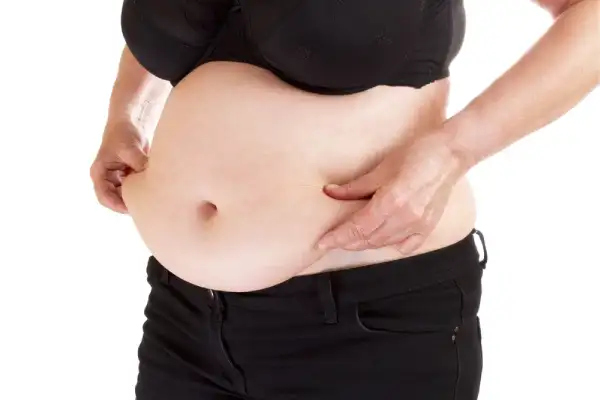 خطرات ابدومینوپلاستی همزمان با سزارین