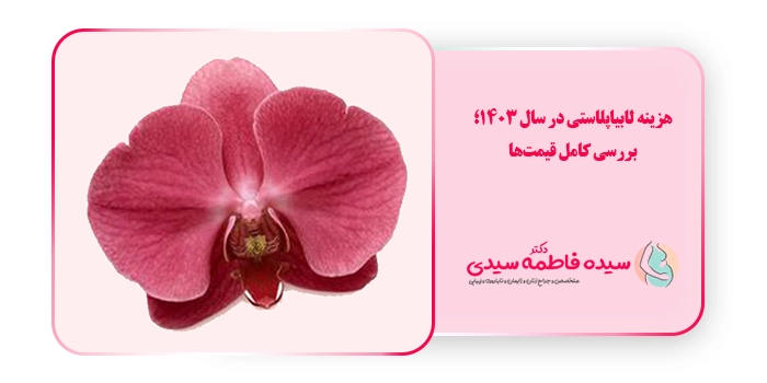 هزینه لابیاپلاستی در سال 1403؛ بررسی کامل قیمتها