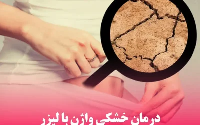 درمان خشکی واژن با لیزر: روشی موثر و بدون نیاز به جراحی