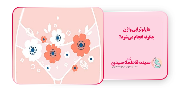 هایفوتراپی واژن چگونه انجام می‌شود؟