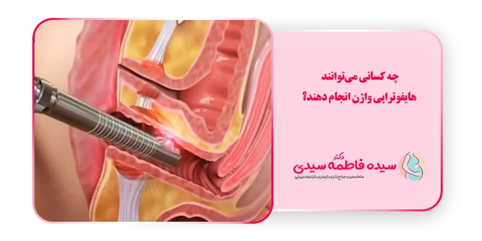 چه کسانی می‌توانند هایفوتراپی واژن انجام دهند؟