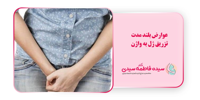 عوارض بلند مدت تزریق ژل به واژن