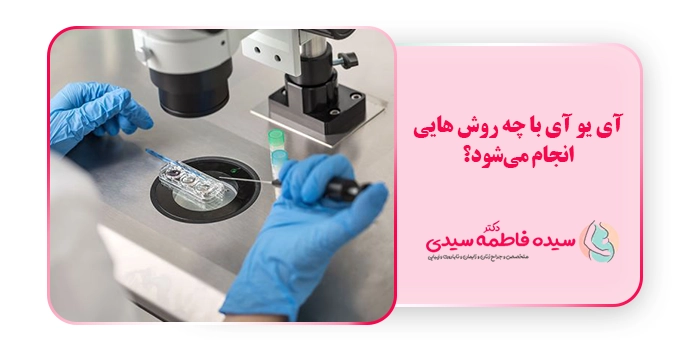 آی یو آی با چه روش هایی انجام می‌شود؟